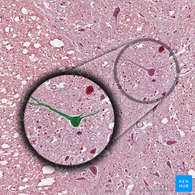 Neuron multipolare (Multipolare Nervenzelle); Bild: 