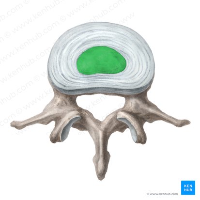 Nucleus pulposus disci intervertebralis (Gallertkern der Bandscheibe); Bild: Liene Znotina