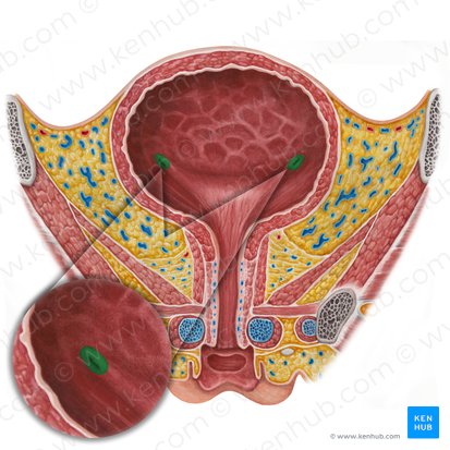 Ureteric orifice (Ostium ureteris); Image: Irina Münstermann