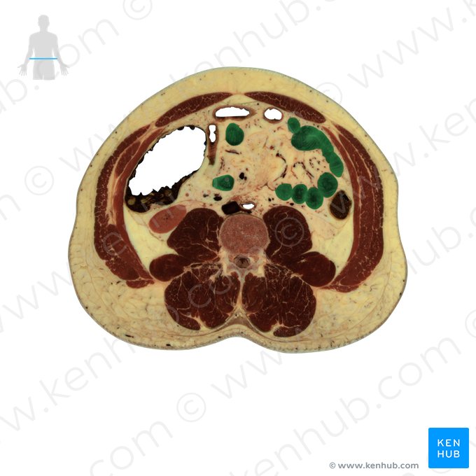 Jejunum (Leerdarm); Bild: National Library of Medicine