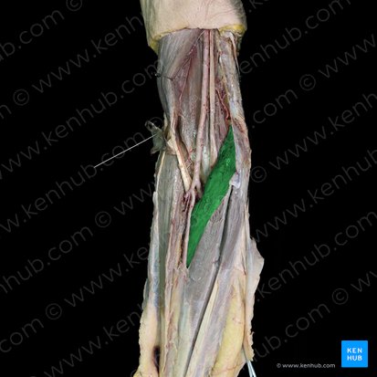 Musculus pronator teres (Runder Einwärtsdreher); Bild: 