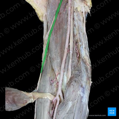 Nervo musculocutâneo (Nervus musculocutaneus); Imagem: 