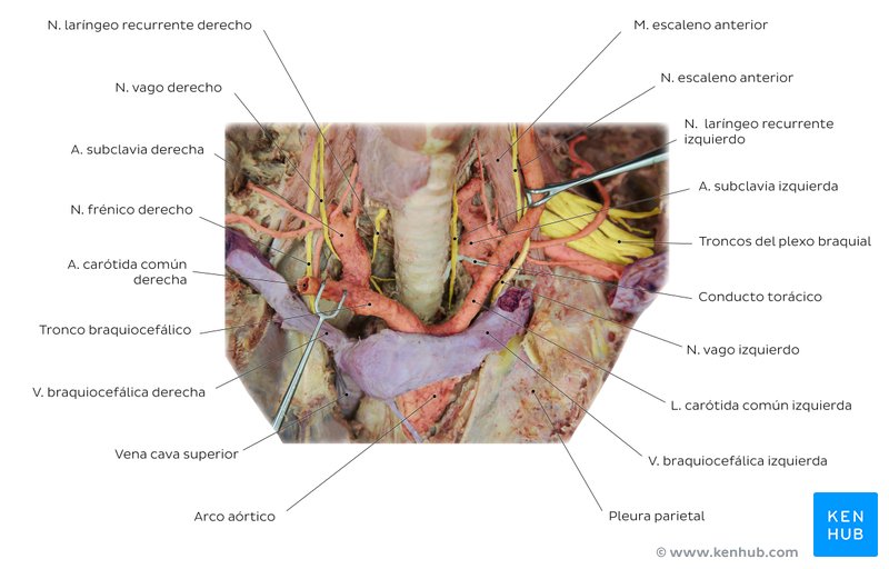 Anatomía de la arteria subclavia en un cadáver.
