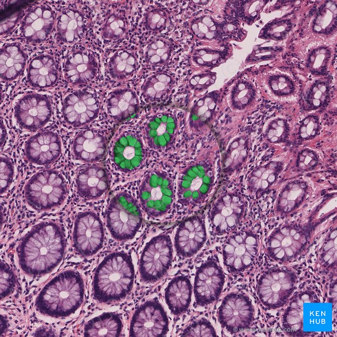 Goblet cell (Exocrinocytus caliciformis); Image: 