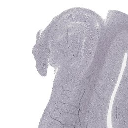 Hippocampal region