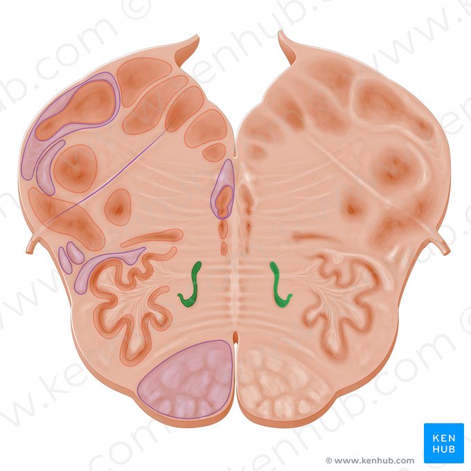 Medial accessory olivary nucleus (Nucleus olivaris accessorius medialis); Image: Paul Kim