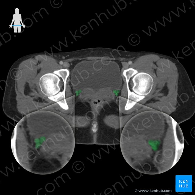 Plexo venoso vaginal (Plexus venosus vaginalis); Imagen: 