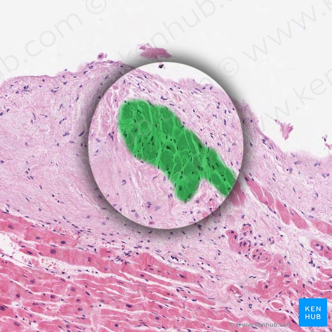 Neurofibrae purkinjensia (Bündel von Purkinje-Fasern); Bild: 