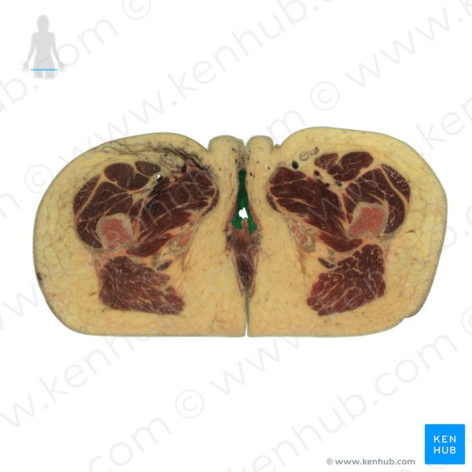 Labium minus of vulva (Labium minus vulvae); Image: National Library of Medicine