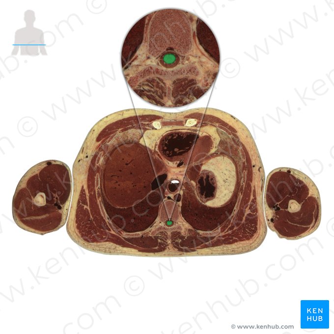 Medula espinal (Medulla spinalis); Imagem: National Library of Medicine