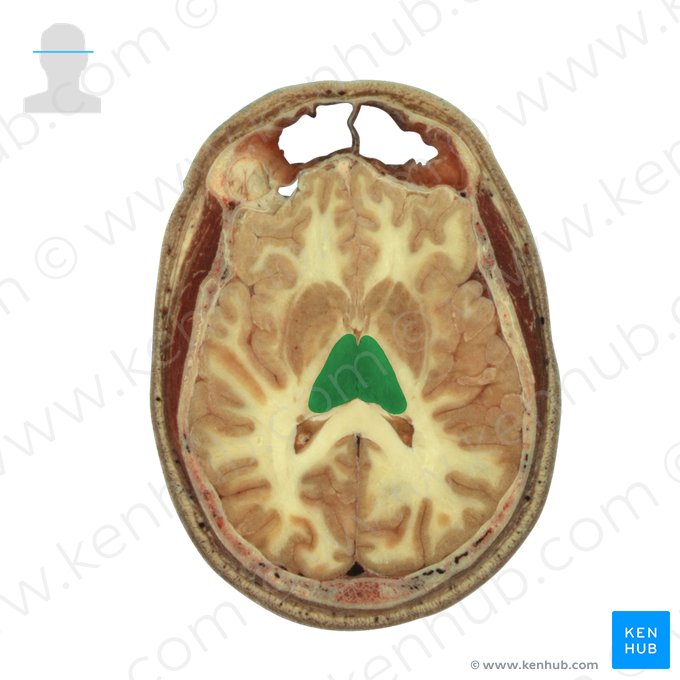 Tálamo (Thalamus); Imagem: National Library of Medicine