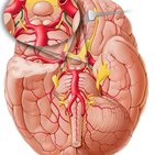 Anterior choroidal artery