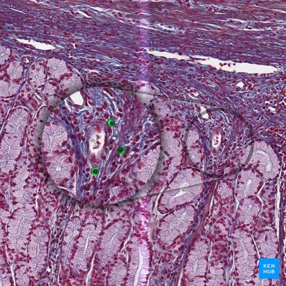 Células plasmáticas (Plasmocytus); Imagen: 