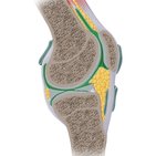 Anatomische Diagnostik - Arthroskopie