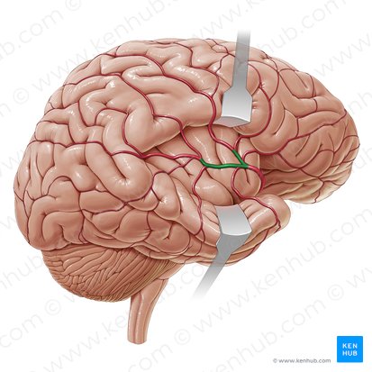 Ramas terminales superior e inferior de la arteria cerebral media (Partes corticales superiores et inferiores arteriae cerebri mediae); Imagen: Paul Kim