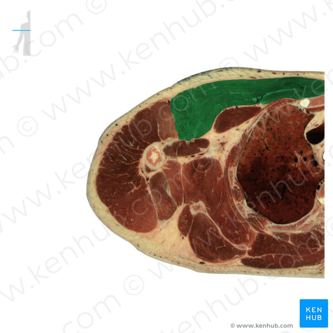 Músculo peitoral maior (Musculus pectoralis major); Imagem: National Library of Medicine