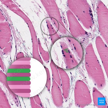 I band (Stria I); Image: 