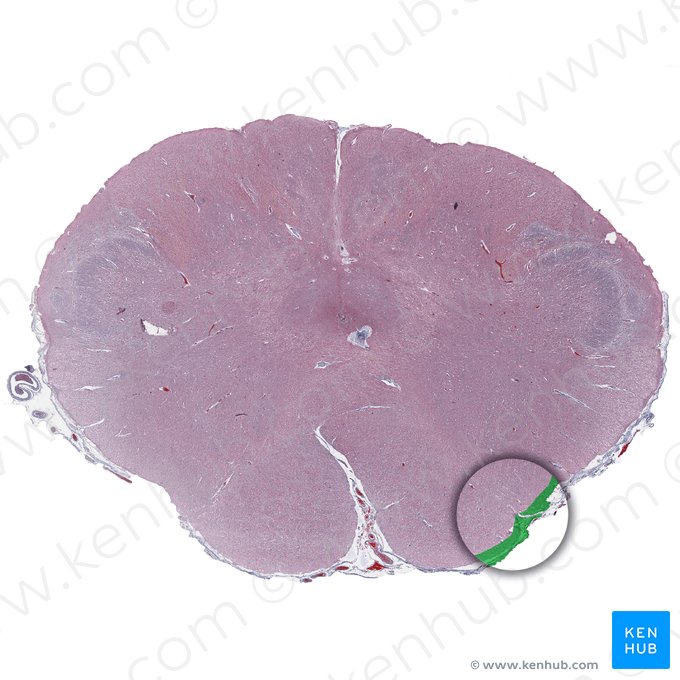 Núcleo arqueado do bulbo raquidiano (Nucleus arcuatus medullae oblongatae); Imagem: 