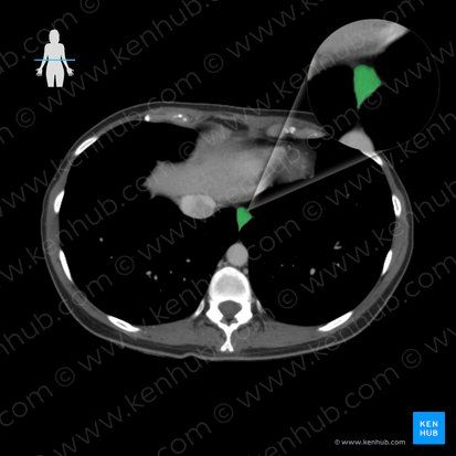 Esophagus (Oesophagus); Image: 