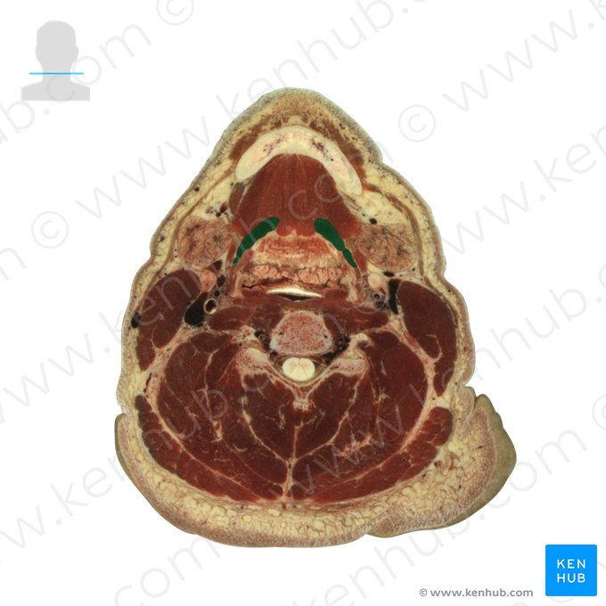 Musculus hyoglossus (Zungenbein-Zungen-Muskel); Bild: National Library of Medicine