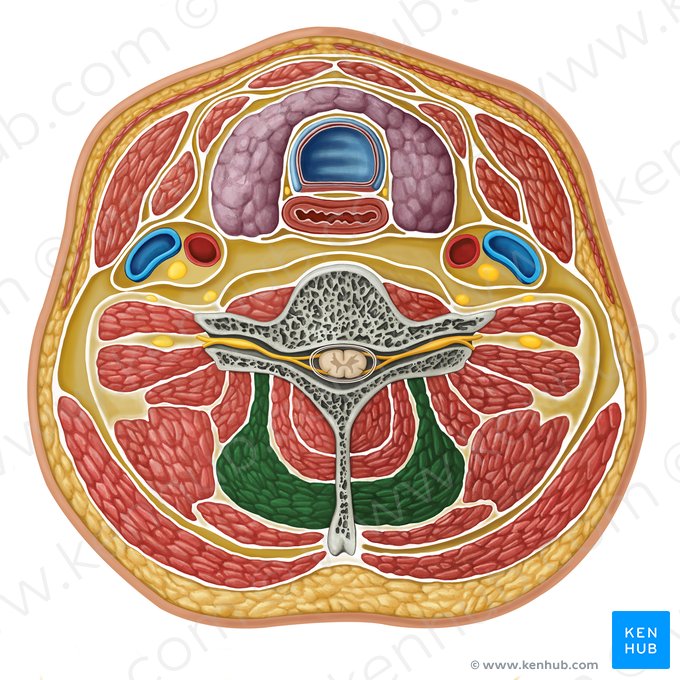 Músculo semiespinoso de la cabeza (Musculus semispinalis capitis); Imagen: Irina Münstermann