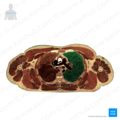 Left lung (Pulmo sinister); Image: National Library of Medicine