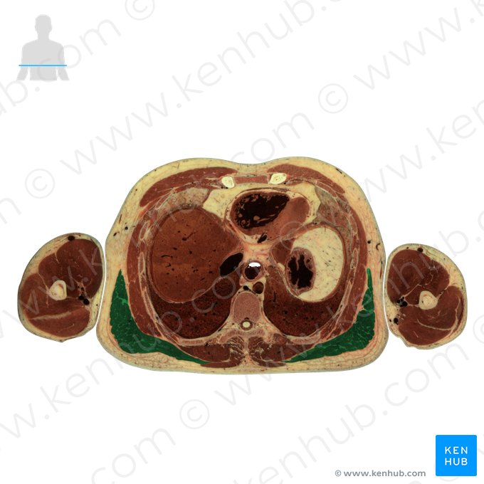 Musculus latissimus dorsi (Breiter Rückenmuskel); Bild: National Library of Medicine