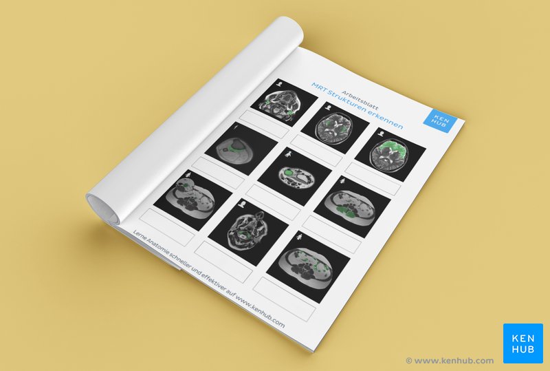 Teste mit unserem unbeschrifteten Arbeitsblatt deine Fähigkeit, MRT Bilder zu lesen und anatomische Strukturen in der medizinischen Bildgebung zu identifizieren (Download unten!)