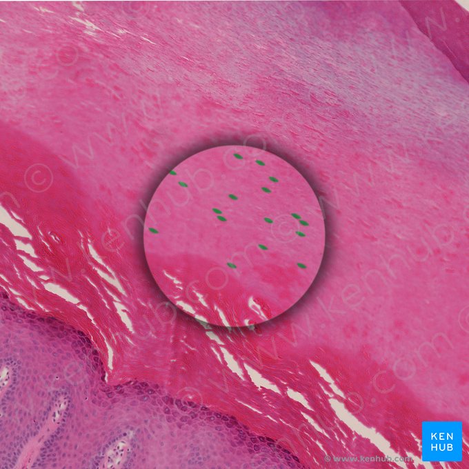 Corneocyte (Corneocytus epidermalis); Image: 