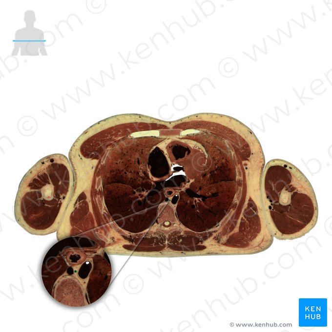 Thoracic duct (Ductus thoracicus); Image: National Library of Medicine