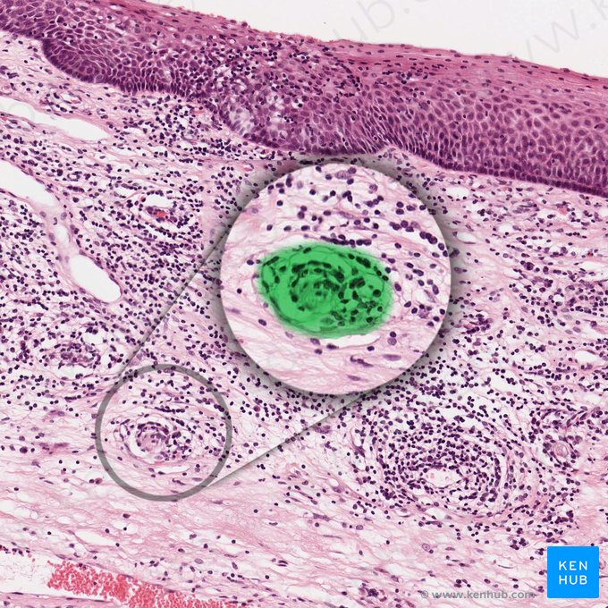 Bulbous corpuscle (of Krause) (Corpusculum genitale); Image: 