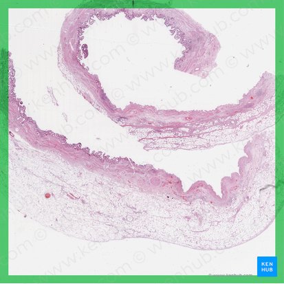 Gallbladder (Vesica biliaris); Image: 