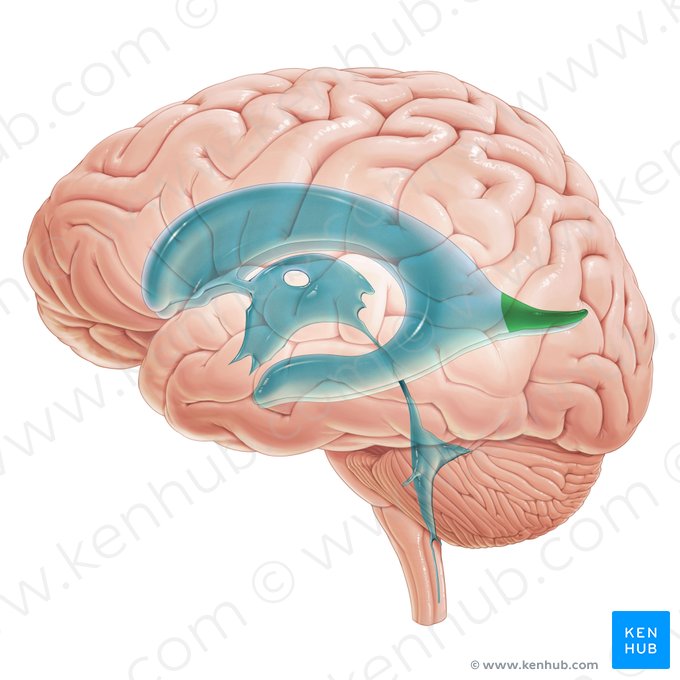 Asta occipital del ventrículo lateral (Cornu occipitale ventriculi lateralis); Imagen: Paul Kim