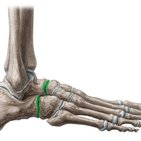 Transverse tarsal joint