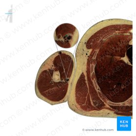 Arteria braquial (Arteria brachialis); Imagen: National Library of Medicine