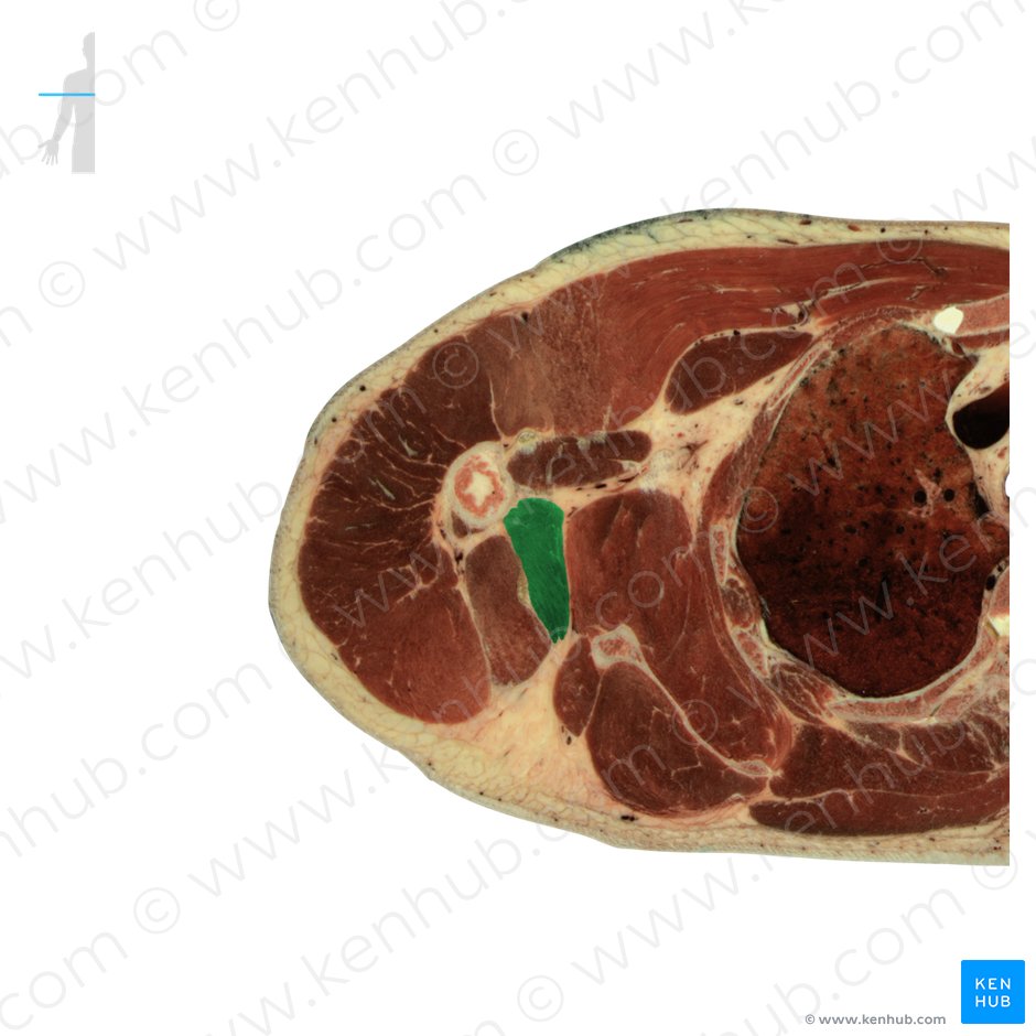 Teres major muscle: Anatomy, function, clinical aspects | Kenhub