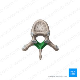 Lamina of vertebral arch (Lamina arcus vertebrae); Image: Liene Znotina