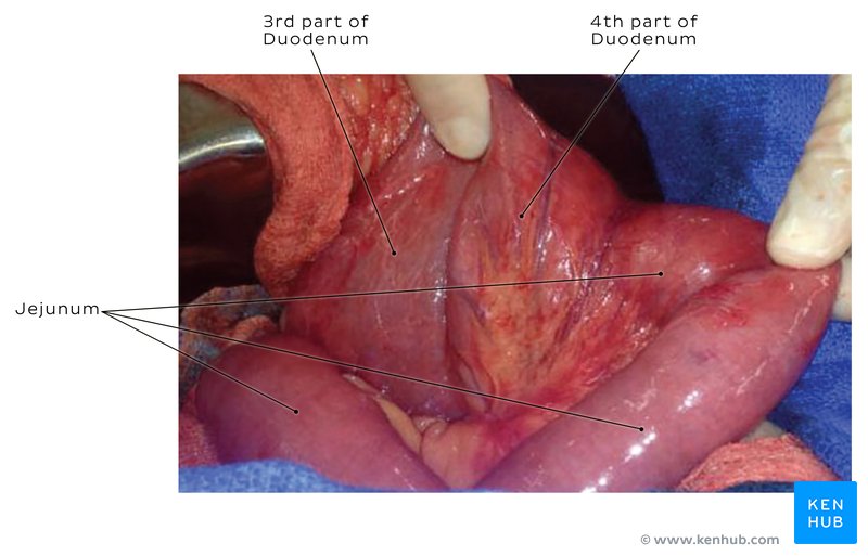 Duodenum and jejunum during a surgical intervention