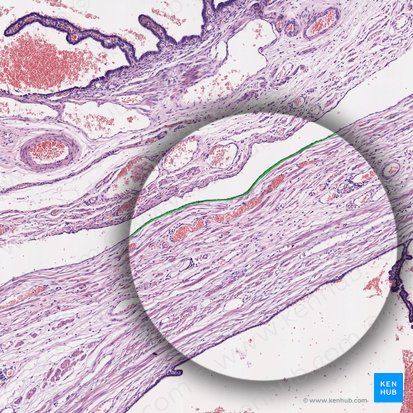 Mesothelium (Mesothel); Bild: 