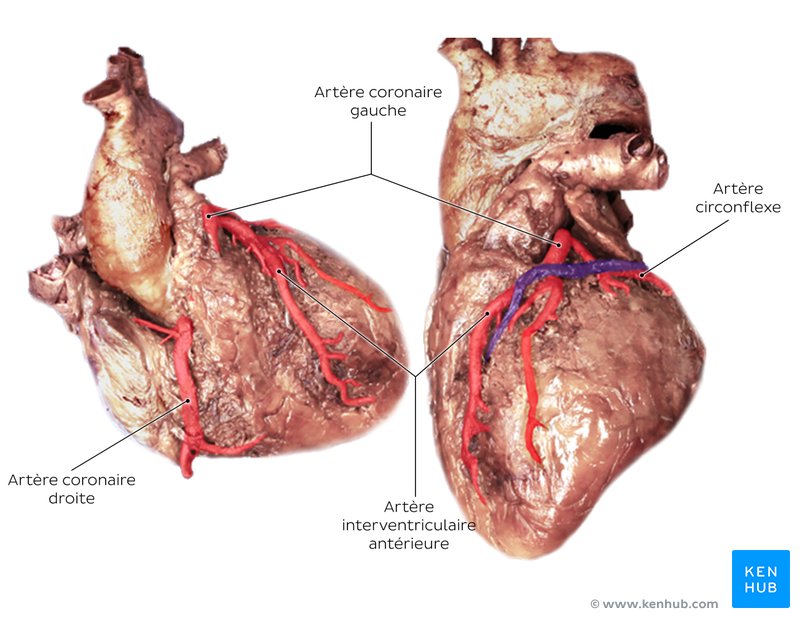Coronary circulation in a cadaver