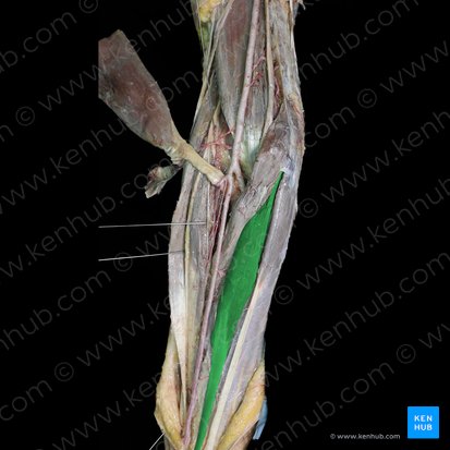 Musculus flexor carpi radialis (Speichenseitiger Handbeuger); Bild: 