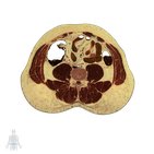 Fourth lumbar vertebra level