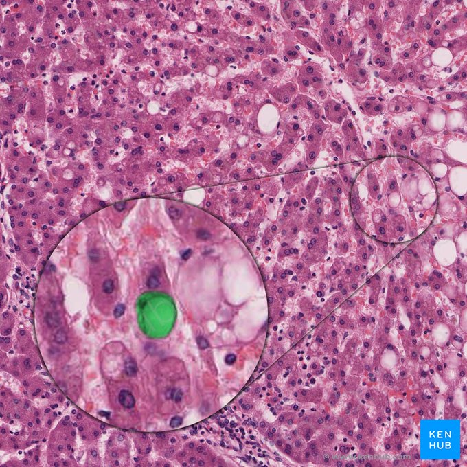 Células estrelladas hepáticas (Cellula perisinusoidalis); Imagen: 