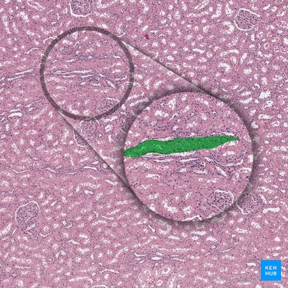 Proximal straight tubule (Pars recta tubuli proximalis); Image: 