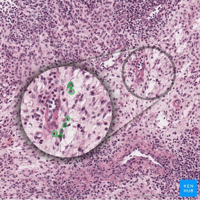 Citoplasma de célula reticular; Imagem: 