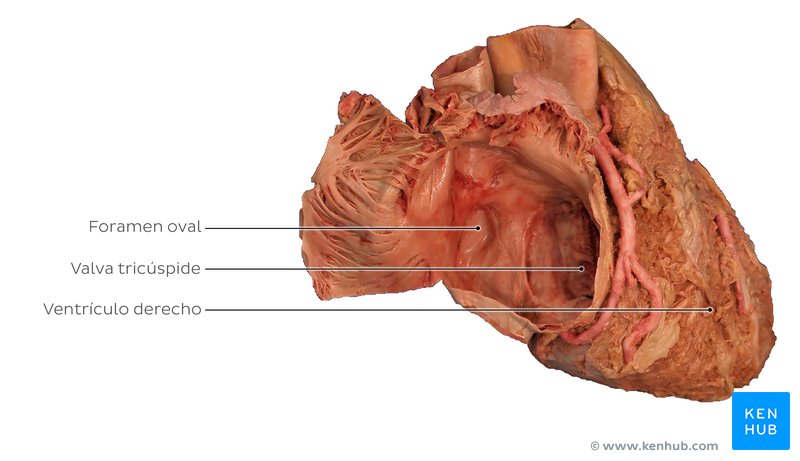 Atrio derecho disecado en un cadáver. La imagen muestra la valva atrioventricular derecha, que comunica el atrio y el ventrículo derecho.