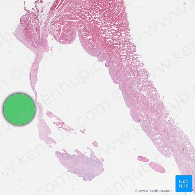 Left atrium of heart (Atrium sinistrum cordis); Image: 