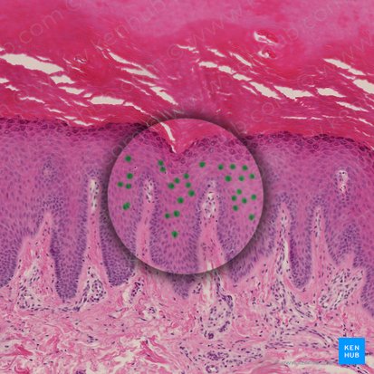 Keratinocytus spinosus (Keratinozyt im Stratum spinosum); Bild: 