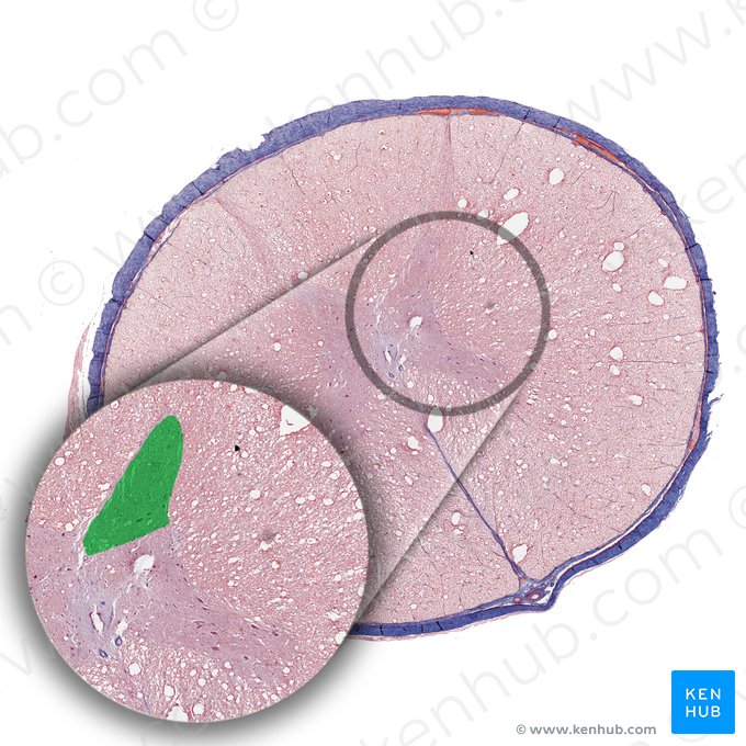 Asta posterior de la médula espinal (Cornu posterius medullae spinalis); Imagen: 