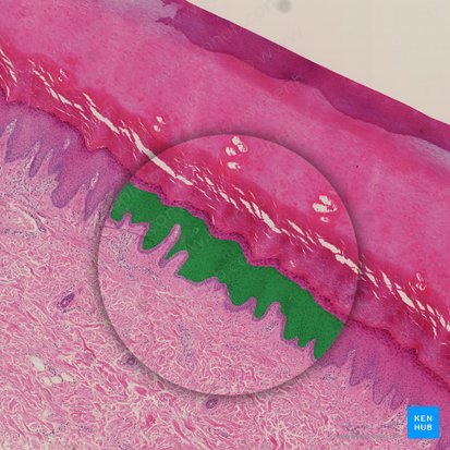 Estrato espinoso (Stratum spinosum epidermis); Imagen: 